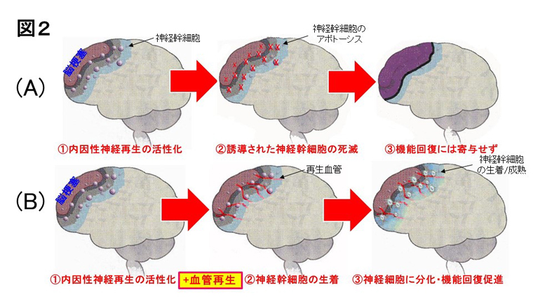 (図2)脳梗塞後再生過程の経時的変化