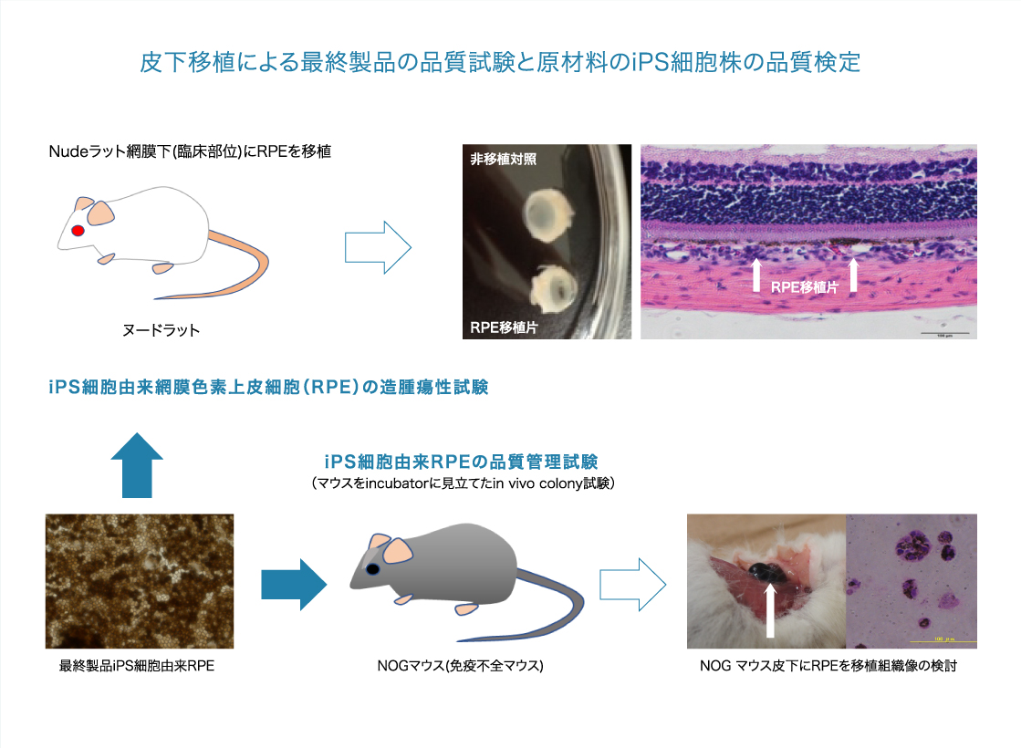 皮下移植による最終製品の品質試験と原材料のiPS細胞株の品質検定